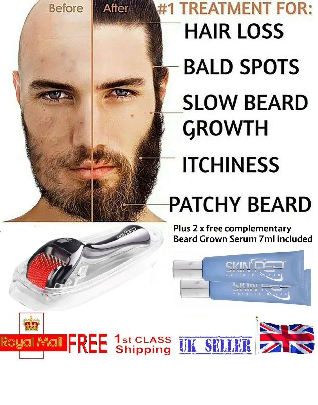 Derma Roller For Beard & Hair - 540 Titanium & Gold Micro Needles 0.30mm - 3.0mm By SkinPep®